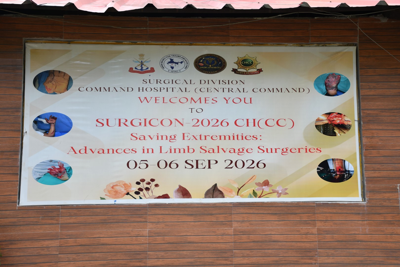 SURGICON-2026 CH (CC)- SAVING EXTREMITIES: ADVANCES IN LIMB SALVAGE SURGERIES